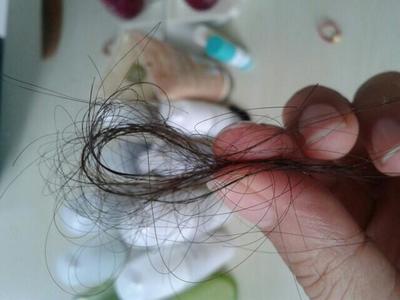 梳洗之擾，發絲何故漸疏？——探析洗浴用品與女性脫發加劇的關聯